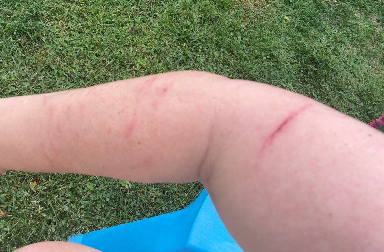 Raspberry Skin Patch Overheard in the Raspberry Patch | Trail Baboon